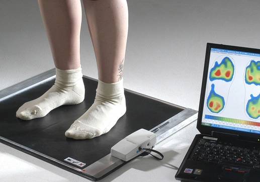 Laufdiagnostik & Fußvermessung Beispielbild